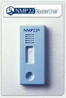 citoscopie cu testul NMP22